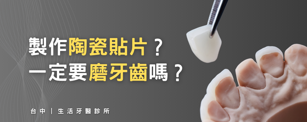 台中陶瓷美齒貼片牙醫推薦