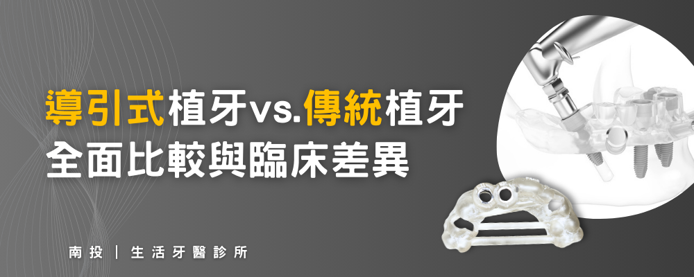 導引式植手vs傳統植牙，哪種比較好？全面大比較-南投植牙推薦生活牙醫