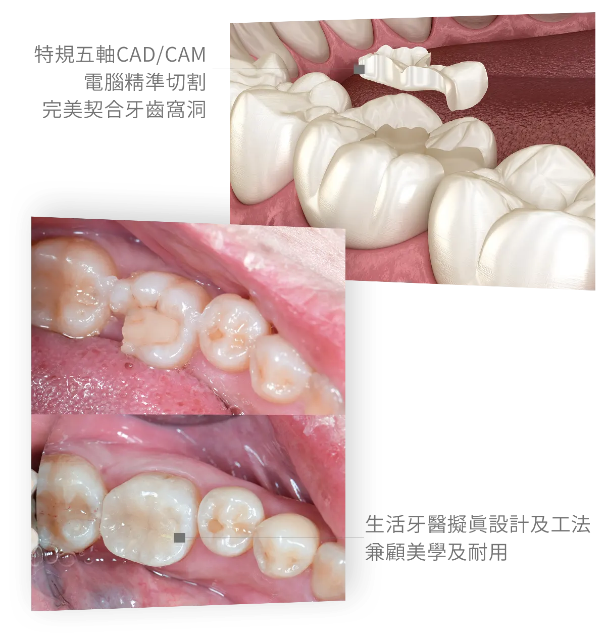 台中南投生活牙醫生活牙醫 CEREC 3D 齒雕陶瓷嵌體製作設備