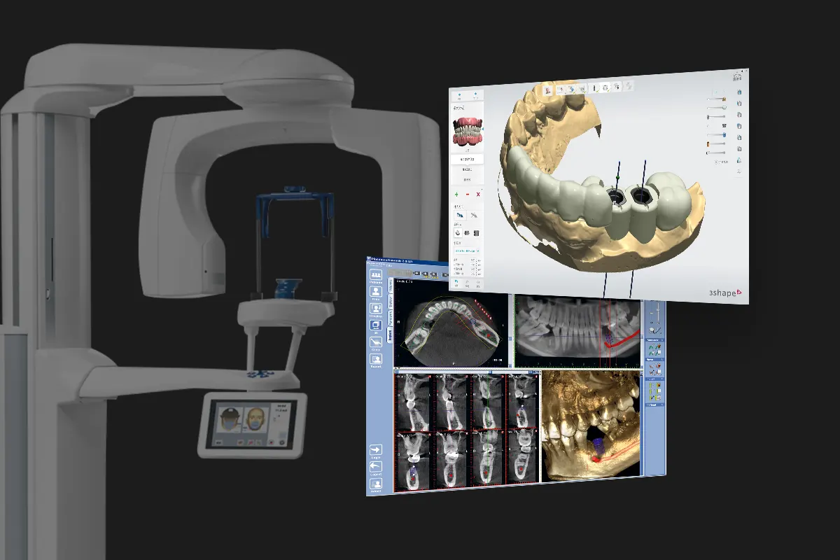 台中南投生活牙醫植牙 Planmeca ProMax 口腔 3D 斷層攝影