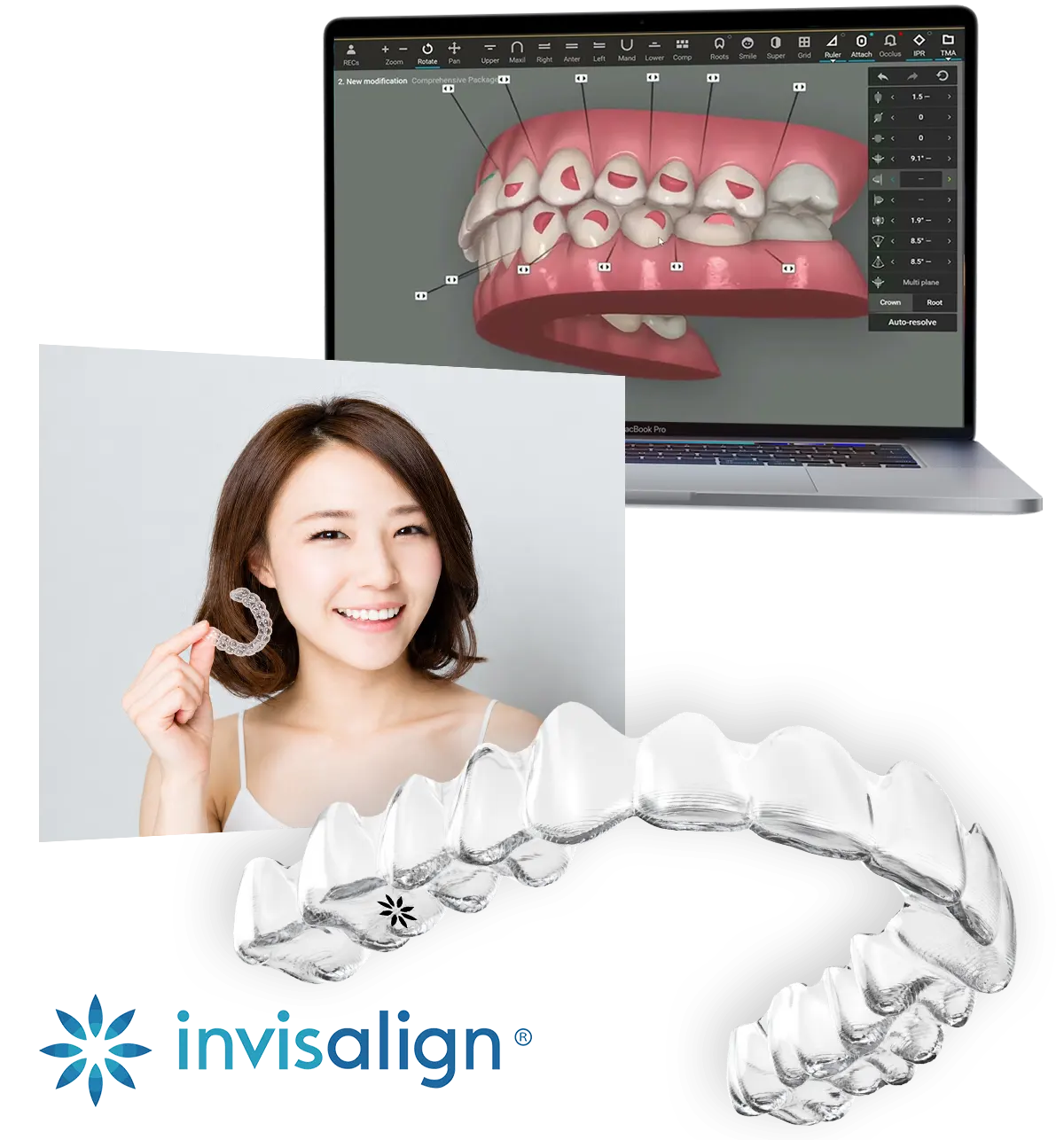 台中南投生活牙醫生活牙醫 Invisalign 透明牙套與數位隱形矯正
