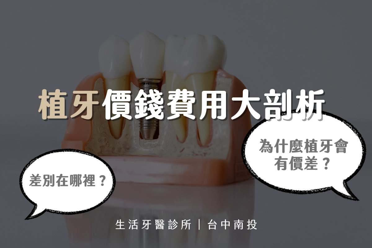 台中植牙∣植牙價錢費用大剖析