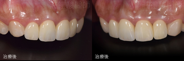 台中牙醫推薦ptt