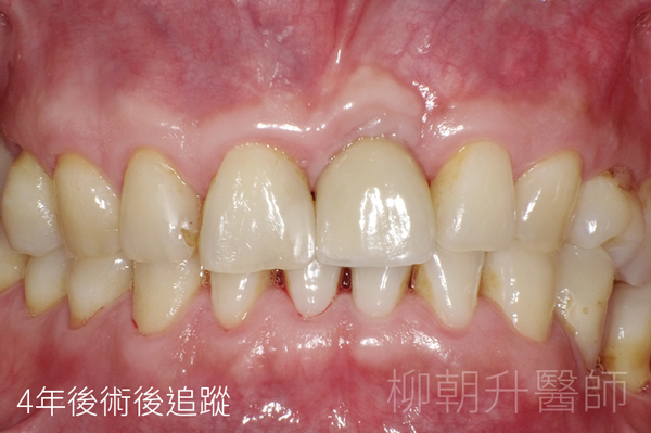 台中牙醫推薦