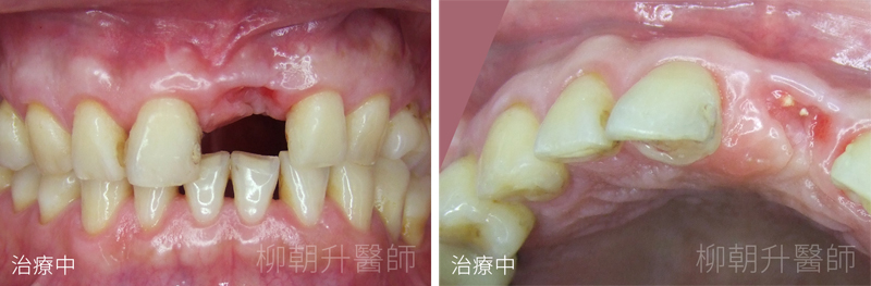 台中牙醫推薦