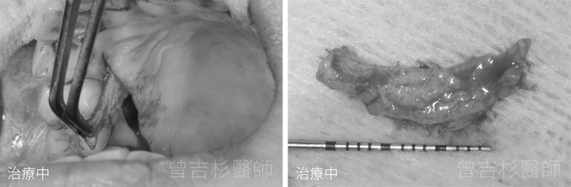 台中牙醫推薦