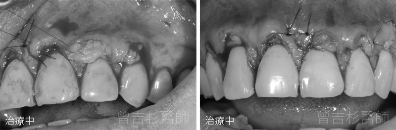 台中牙醫推薦
