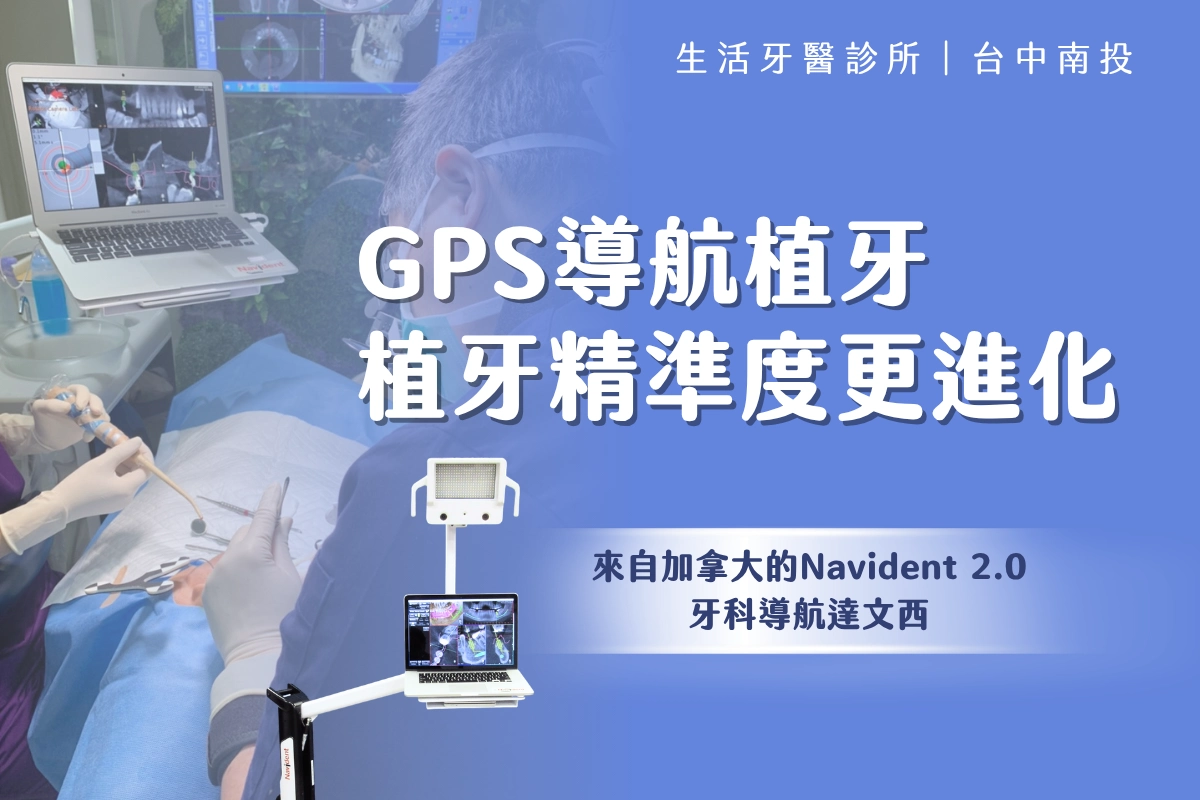 南投植牙∣GPS導航植牙 透視植牙準度更上層樓