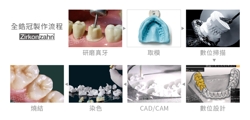 台中南投生活牙醫Zirkonzahn 全鋯冠 CAD CAM 數位製作流程