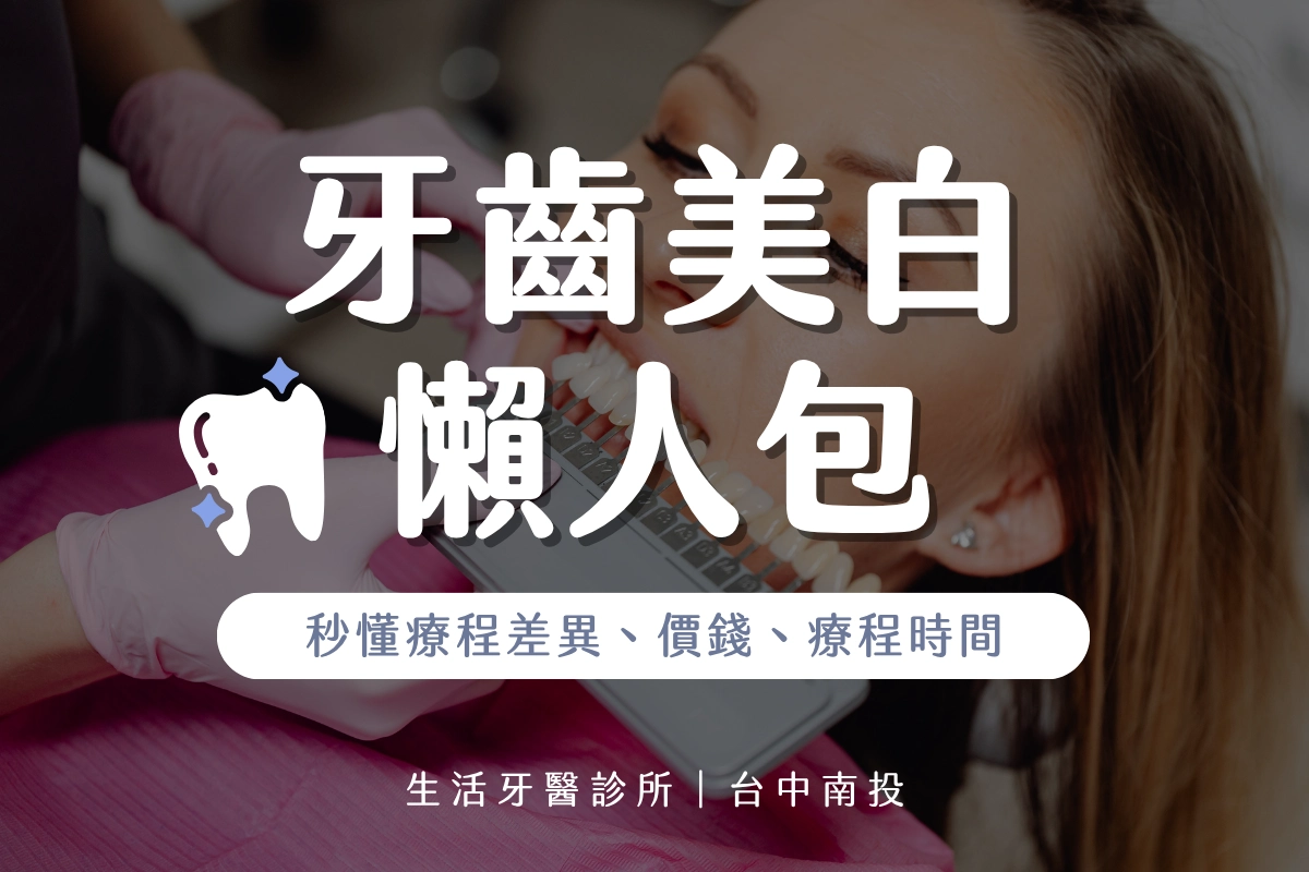 台中冷光美白推薦牙醫 幫你輕鬆秒懂牙齒美白效果差異、價格費用、療程時間、冷光美白維持多久時間