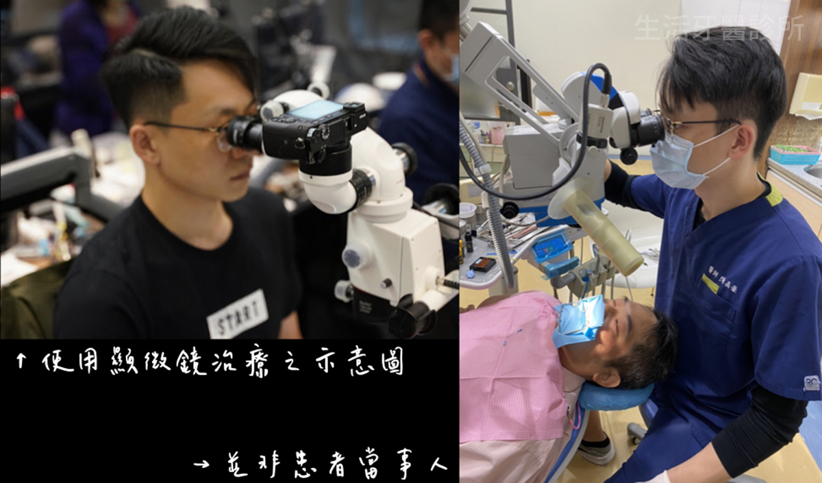 美學奈米樹脂貼片 輕鬆關閉牙縫(門牙牙縫太大)