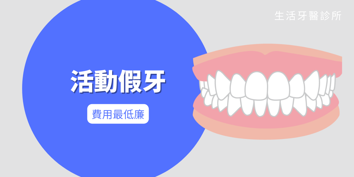全口無牙或多顆缺牙怎麼辦?除了活動假牙有哪些治療方式?