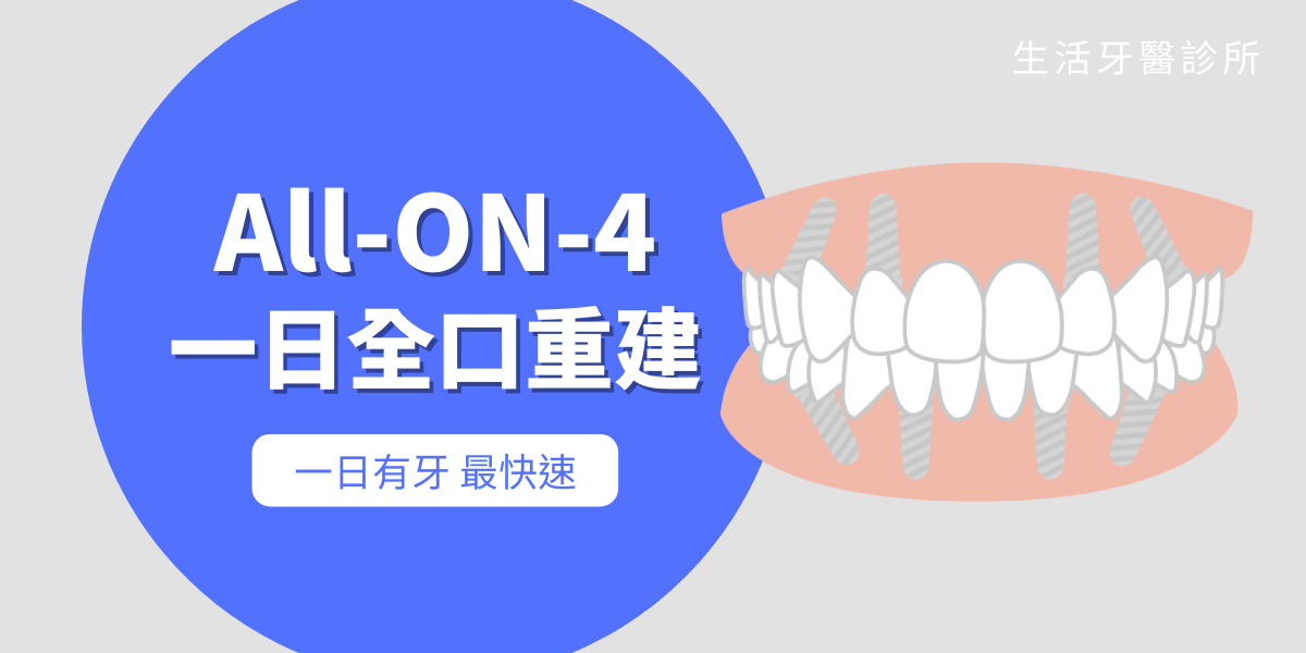 全口無牙或多顆缺牙怎麼辦?除了活動假牙有哪些治療方式?