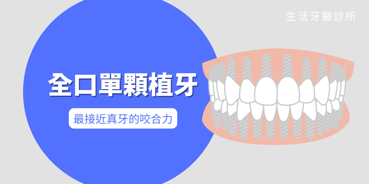 全口無牙或多顆缺牙怎麼辦?除了活動假牙有哪些治療方式?