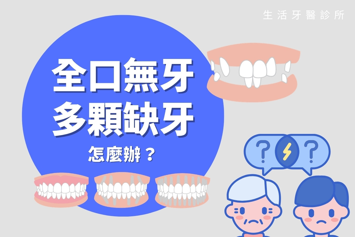 全口無牙或多顆缺牙怎麼辦?除了活動假牙有哪些治療方式?