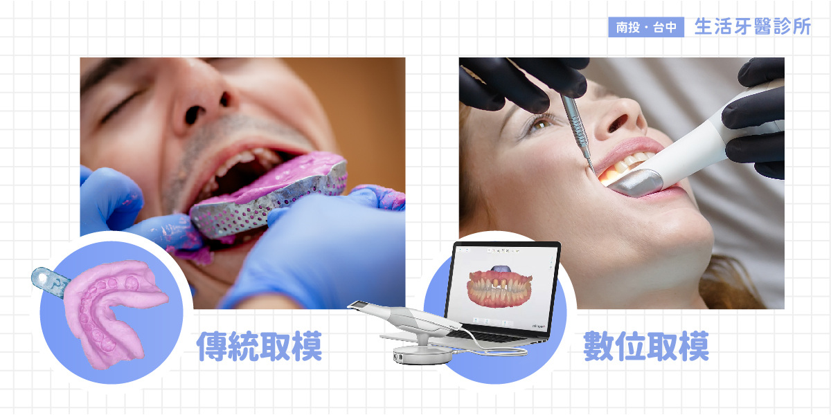 假牙品質好壞 3大製作關鍵