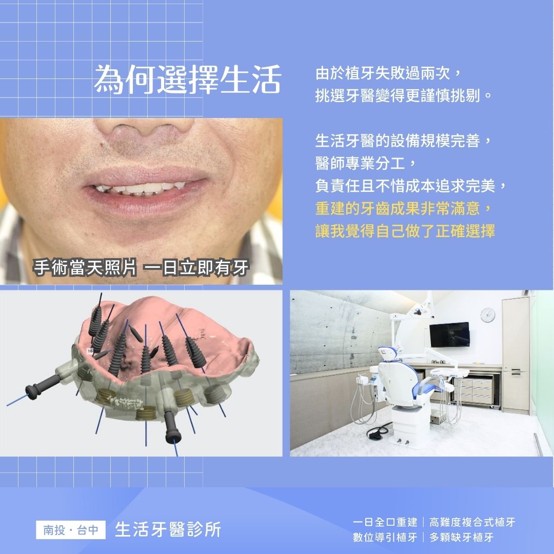【All-On-4全口重建實際案例】自信健康人生,絕對值得投資