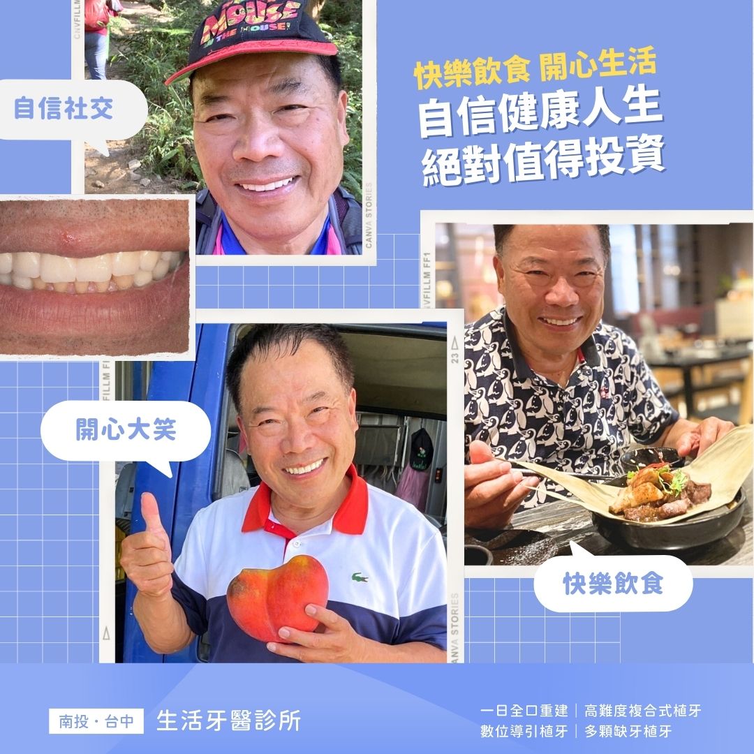 【All-On-4全口重建實際案例】自信健康人生,絕對值得投資