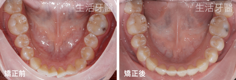南屯矯正推薦+南屯牙醫診所