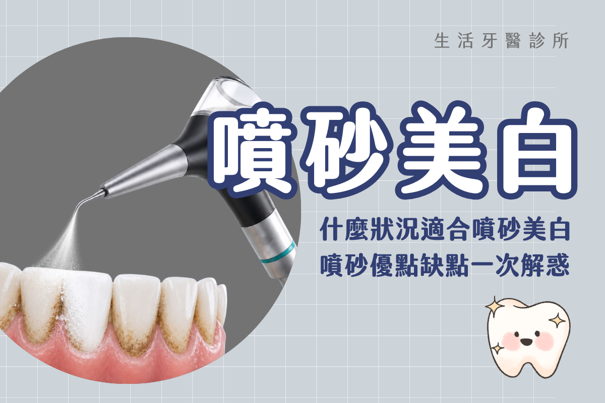 台中南投生活牙醫噴砂美白適用情況與優缺點