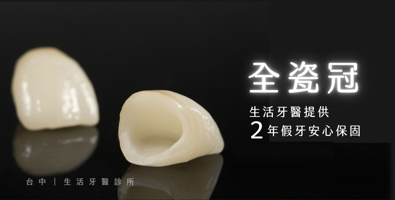 台中生活牙醫全瓷冠假牙加牙齒美白治療門牙蛀牙牙齒變黑