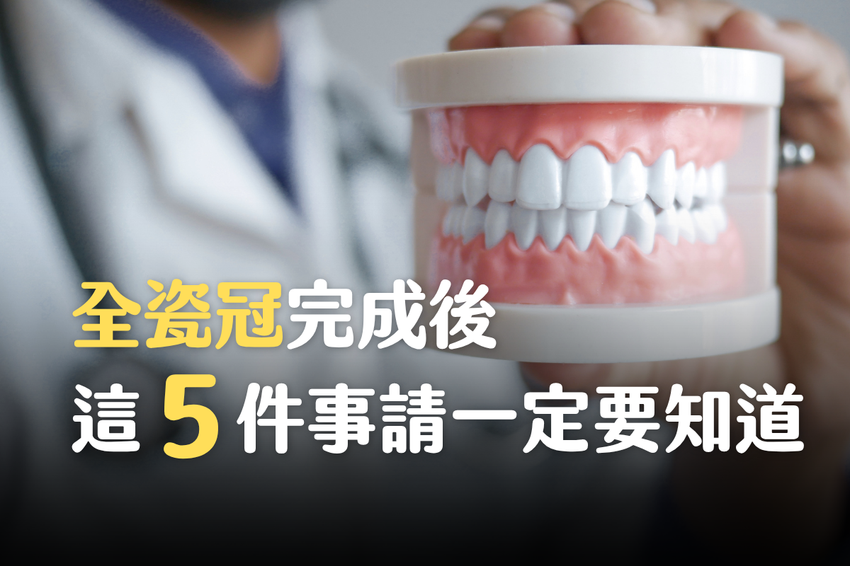 台中南投生活牙醫全瓷冠術後照護示意
