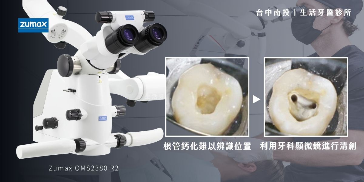 台中南投生活牙醫南投生活牙醫 Zumax 牙科顯微鏡設備