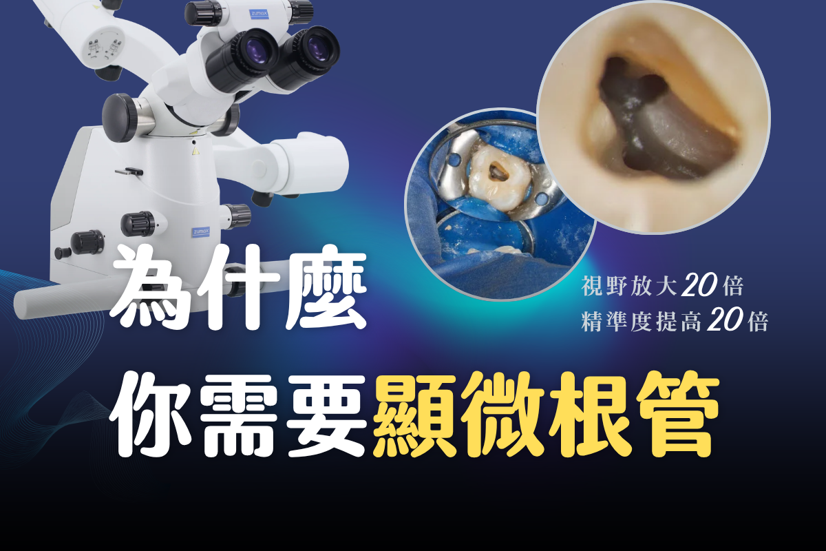 台中南投生活牙醫顯微根管治療文章封面