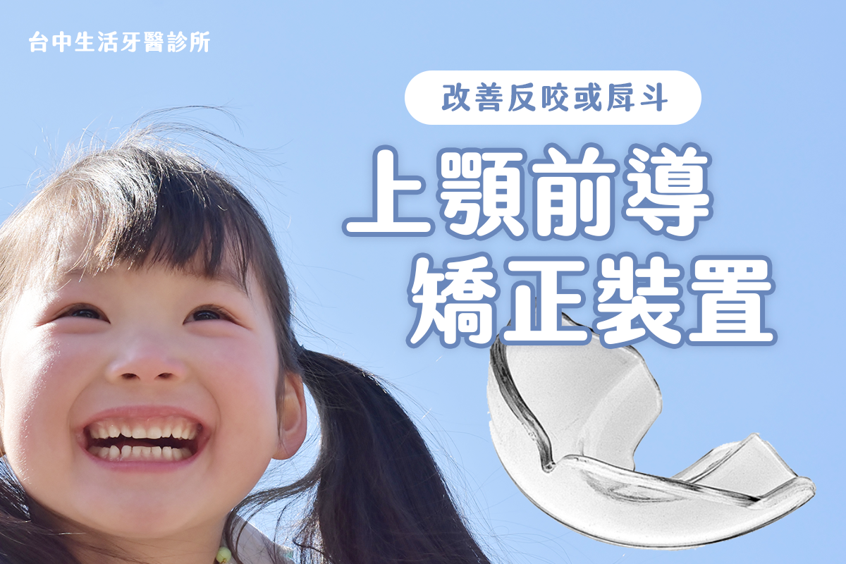 台中南投生活牙醫學齡矯正使用的上顎前導矯正裝置