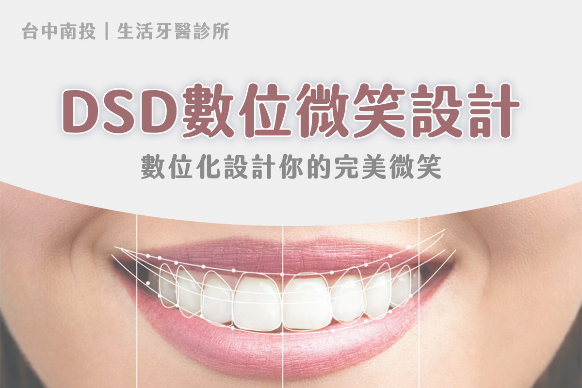 台中南投生活牙醫 DSD 數位微笑設計文章封面